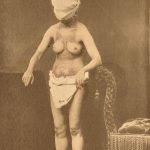 Amateur black and white photograph of a young adult woman with bare torso showing scarring from tuberculosis infection wearing a towel as a hood to cover the face
