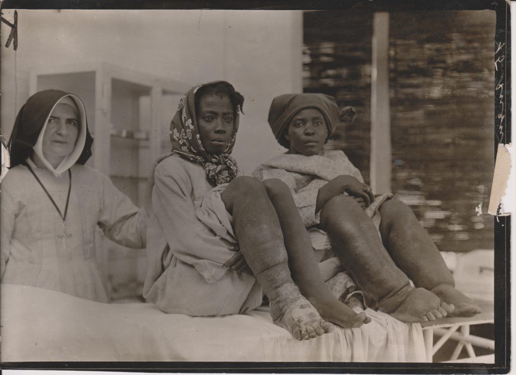 Black and white photograph of two adult females showing elephantiasis of the legs accompanied by a nun