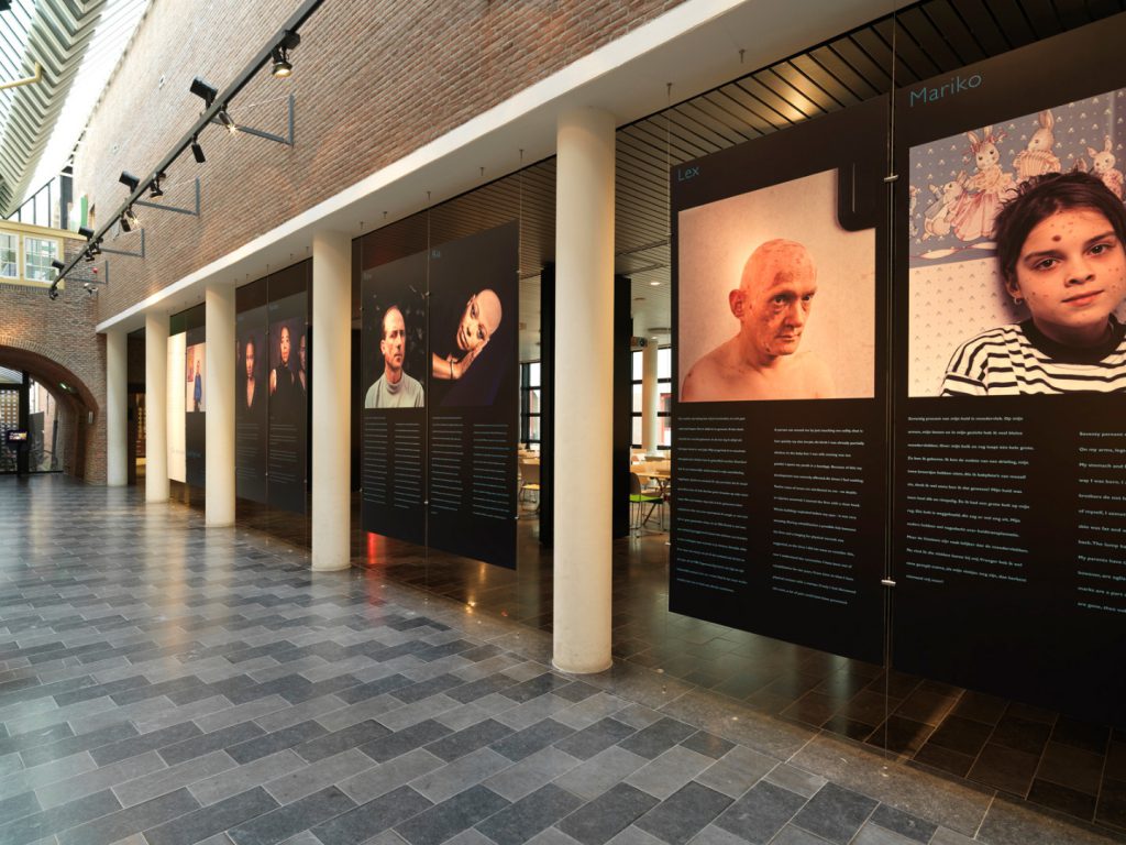 Colour photograph of a modern gallery showing large images of people afflicted with disease