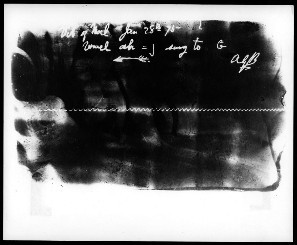 Glass plate etching produced using the ear phonautograph