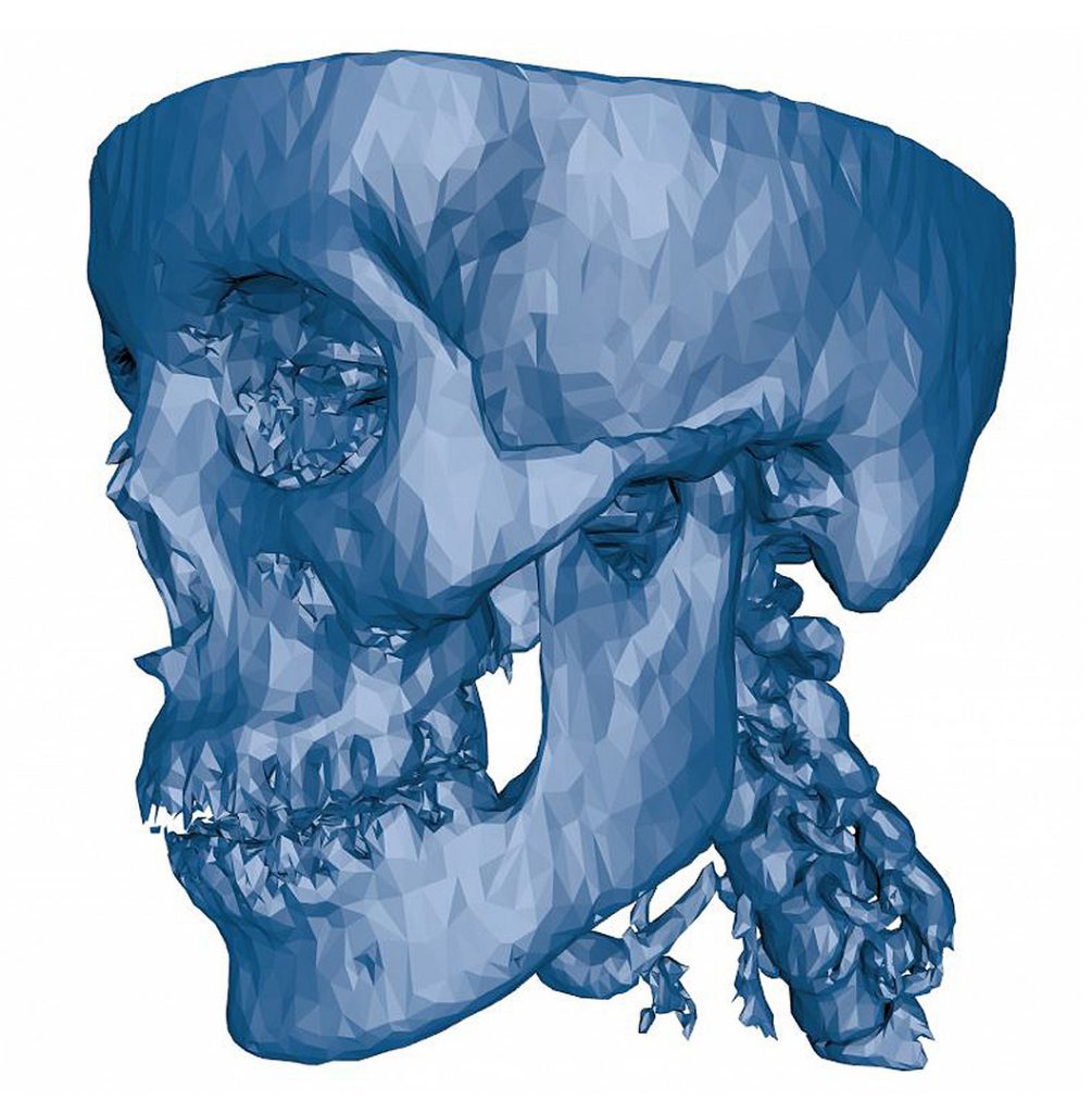 Computer generated three dimensional map of the human skull
