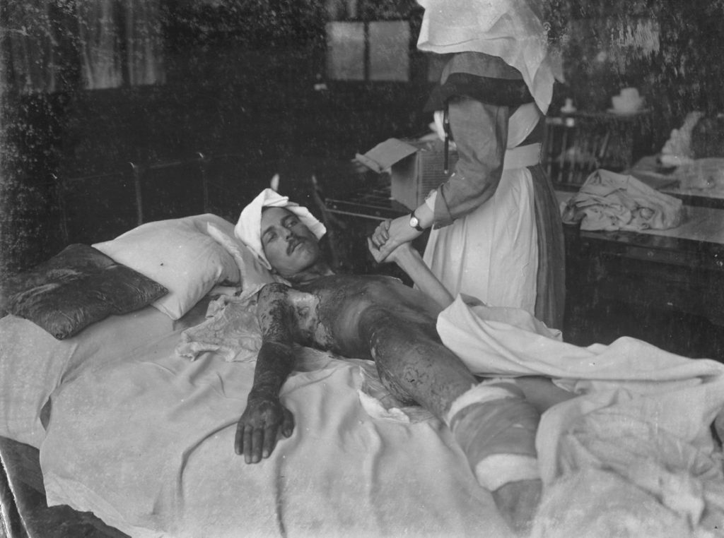 Black and white photograph of a soldier severely injured by gas in the Great War