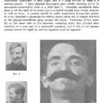 Page from a 1916 journal showing photographs of facial restoration by means of mechanical appliance