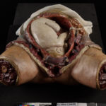Colour photograph of a wax anatomical model showing a baby inside the womb