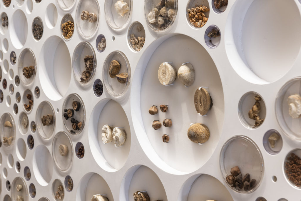 Colour photograph of a urinary stones museum display