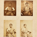 Set of sepia photographs of an Indian female leprosy patient