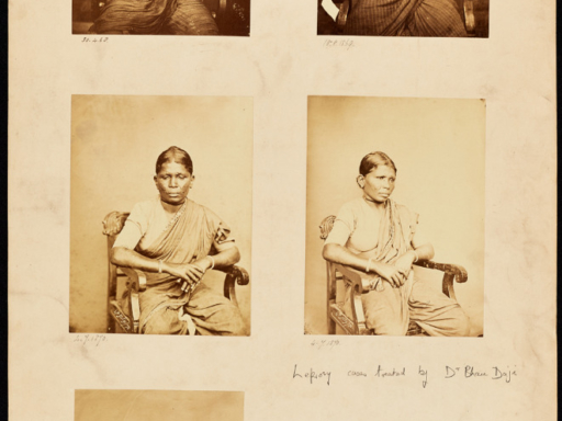 Set of sepia photographs of an Indian female leprosy patient