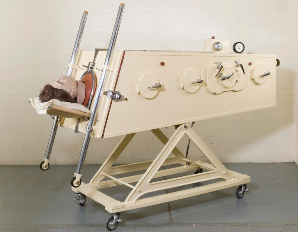 Colour photograph of an iron lung negative pressure ventilator