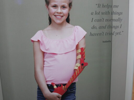 Display within the Wellcome: The Medicine Galleries at the Science Museum. It shows a young girl wearing a prosthetic arm and an accompanying quote. The prosthetic arm was acquired by the Museum and displayed on the other side of this case