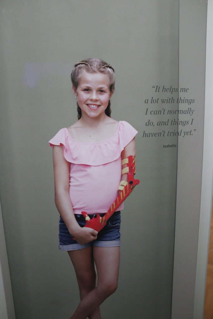 Display within the Wellcome: The Medicine Galleries at the Science Museum. It shows a young girl wearing a prosthetic arm and an accompanying quote. The prosthetic arm was acquired by the Museum and displayed on the other side of this case