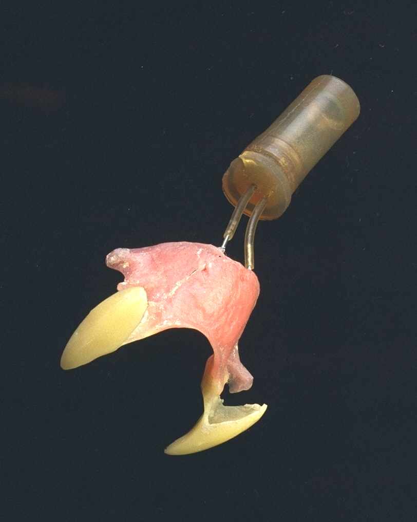 Colour photographic of a pair of prosthetic fangs worn by actor Christopher Lee
