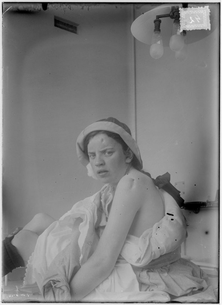 Old black and white photograph of a young woman as a patient in a hospital for treating sufferers of tuberculosis