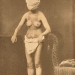 Amateur black and white photograph of a young adult woman with bare torso showing scarring from tuberculosis infection wearing a towel as a hood to cover the face
