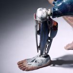 Colour photograph of a 3D printed nylon prosthetic leg as worn by an amputee