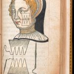 Hand-coloured illustration of facial surgery and suturing technique