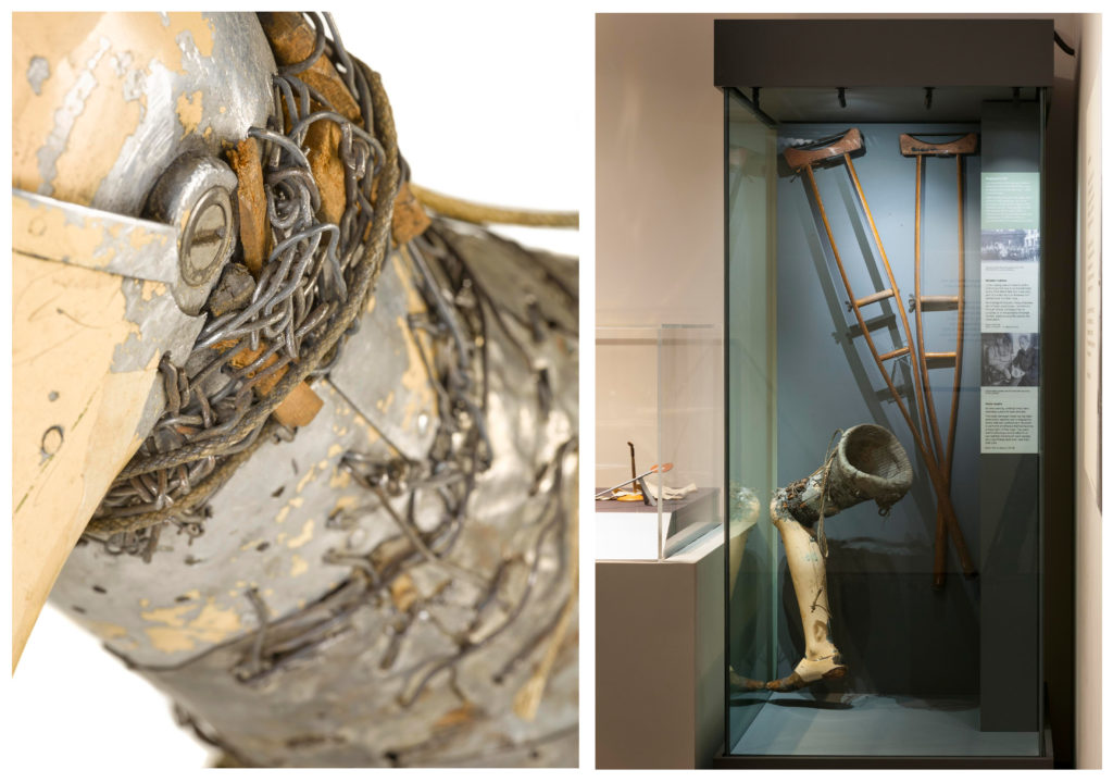 Colour photograph of an artificial leg on display in the gallery