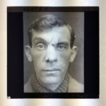A photographic lantern slide from 1918 showing a soldier following reconstructive facial surgery