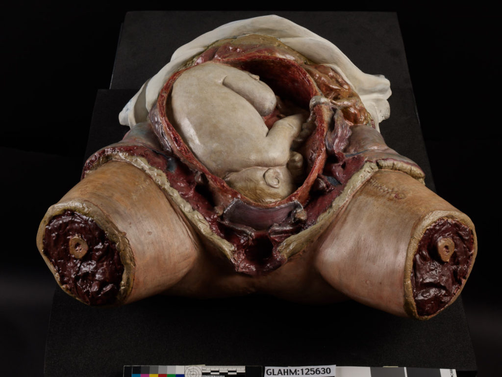 Colour photograph of a wax anatomical model showing a baby inside the womb