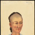 Watercolour portrait of a patient with leprosy