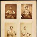 Set of sepia photographs of an Indian female leprosy patient