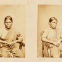 Set of sepia photographs of an Indian female leprosy patient
